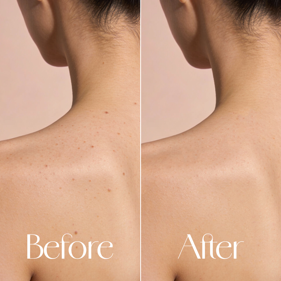 PINK SURGE - Glutathione & Niacinamide Body Wash