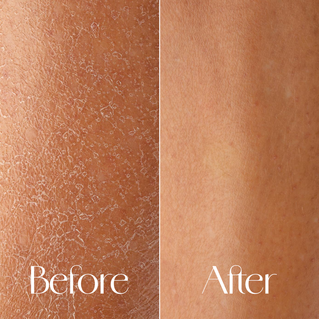 Kissed by Dusk – Niacinamide & Collagen Body Lotion