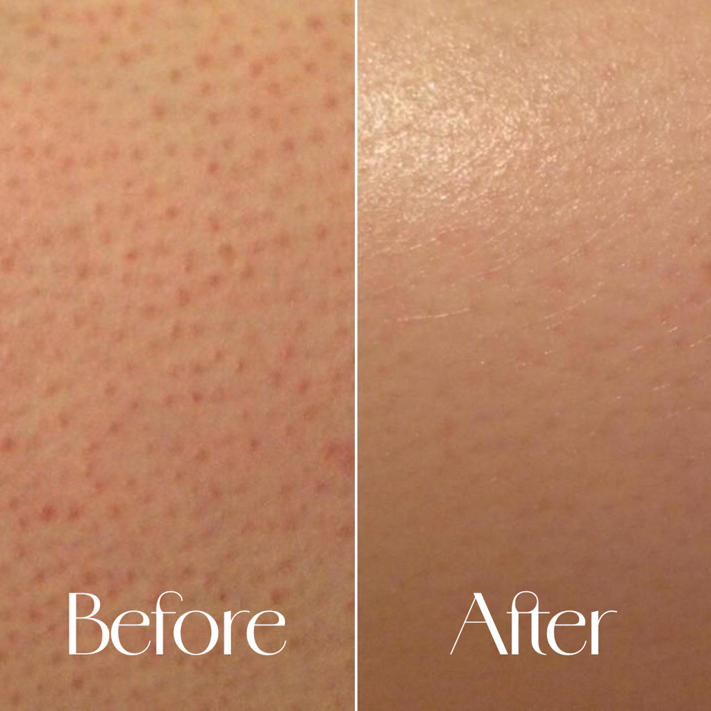 Kissed by Dusk - Niacinamide & Collagen Sugar Body Scrub