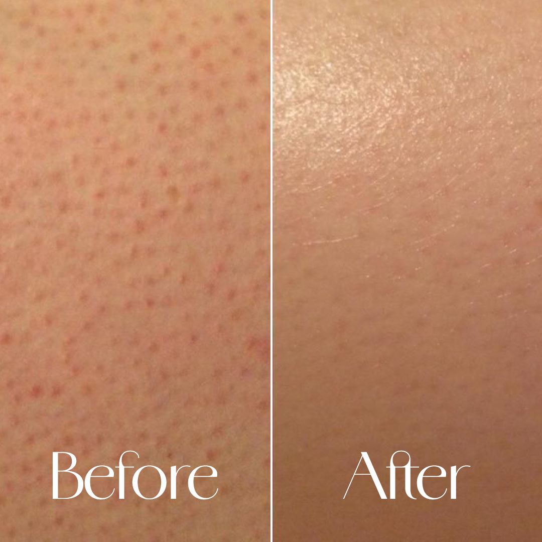 Kissed by Dusk - Niacinamide & Collagen Sugar Body Scrub