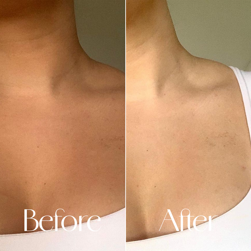 PINK SURGE – Glutathione & Niacinamide Body Lotion