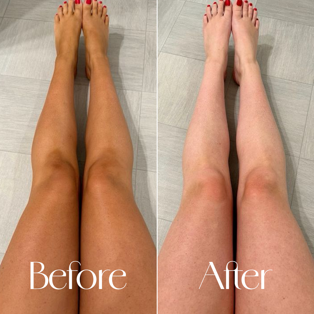 PINK SURGE – Glutathione & Niacinamide Body Scrub